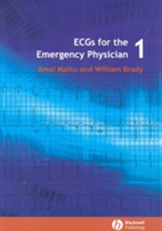 ECGs for the Emergency Physician 1 ECGs for the Emergency Physician 1