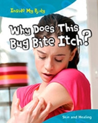 Why does this Bite Itch?