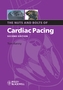 The Nuts and Bolts of Cardiac Pacing