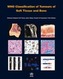 WHO classification of tumours of soft tissue and bone