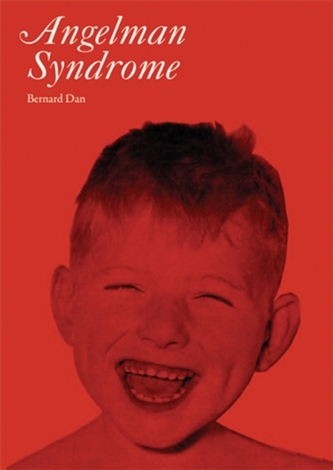 Angelman's Syndrome