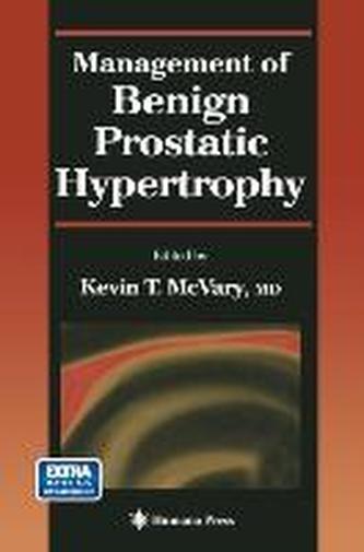 Management of Benign Prostatic Hypertrophy