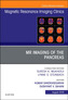 MR Imaging of the Pancreas, An Issue of Magnetic Resonance Imaging Clinics of North America