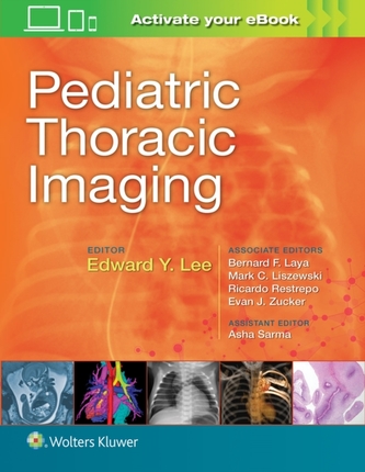 Pediatric Thoracic Imaging