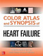 Color Atlas and Synopsis of Heart Failure