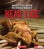 What You Need to Know about Head Lice