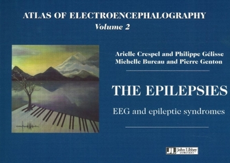 Atlas of Electroencephalography