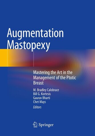 Augmentation Mastopexy