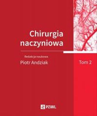 Chirurgia naczyniowa T. 2