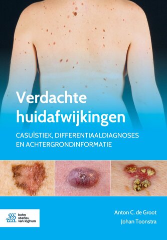 Verdachte huidafwijkingen