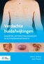Verdachte huidafwijkingen