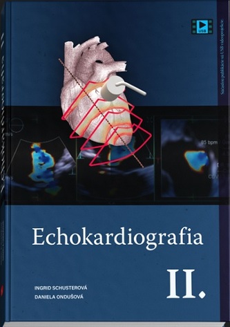 Echokardiografia II.