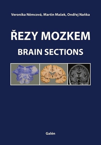Řezy mozkem / Brain Sections