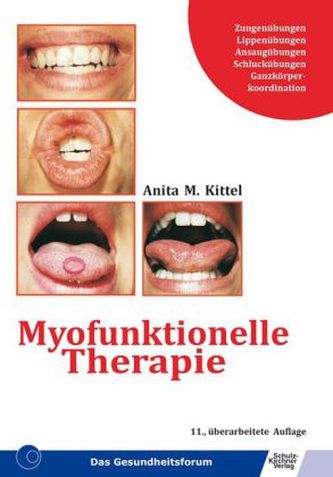 Myofunktionelle Therapie Myofunktionelle Therapie
