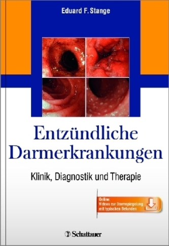 Entzündliche Darmerkrankungen