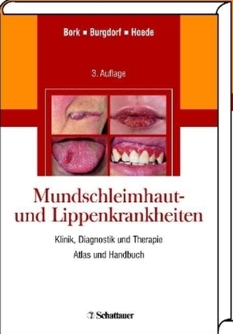 Mundschleimhaut- und Lippenkrankheiten Mundschleimhaut- und Lippenkrankheiten