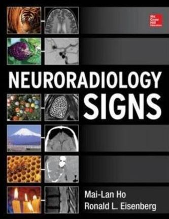 Neuroradiology Signs