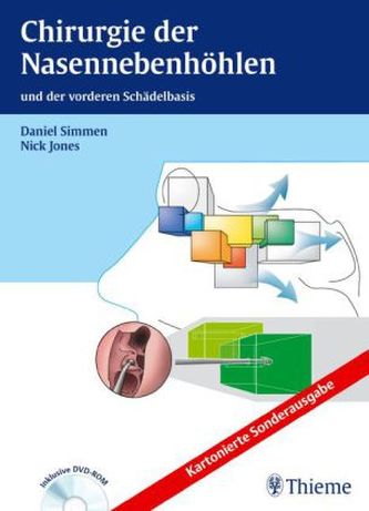 Chirurgie der Nasennebenhöhlen, m. DVD Chirurgie der Nasennebenhöhlen, m. DVD