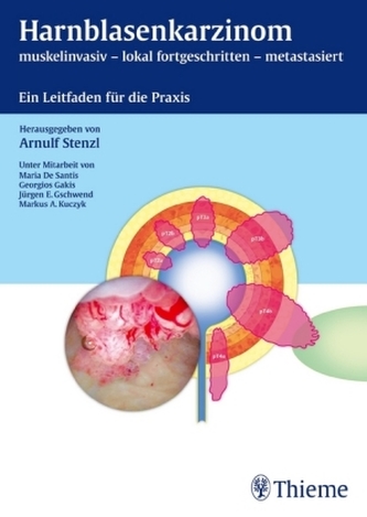 Harnblasenkarzinom