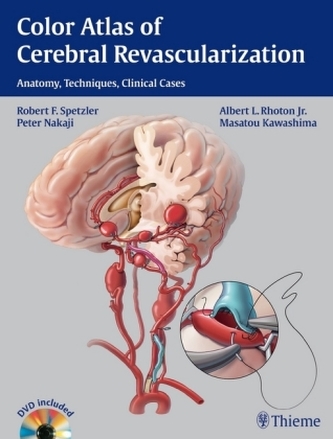 Color Atlas of Cerebral Revascularization, w. DVD
