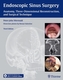 Endoscopic Sinus Surgery