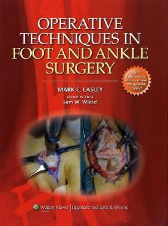 Operative Techniques in Foot and Ankle Surgery