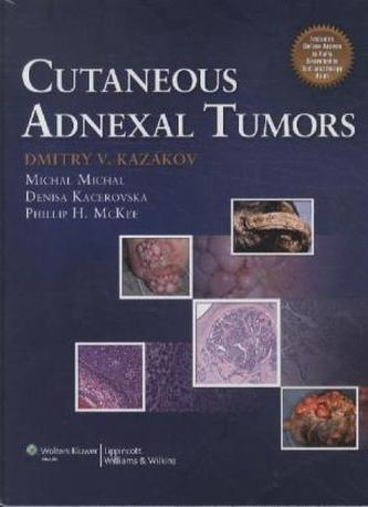 Cutaneous Adnexal Tumors