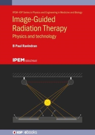 Image-Guided Radiation Therapy