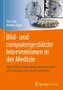 Bild- und computergestützte Interventionen in der Medizin