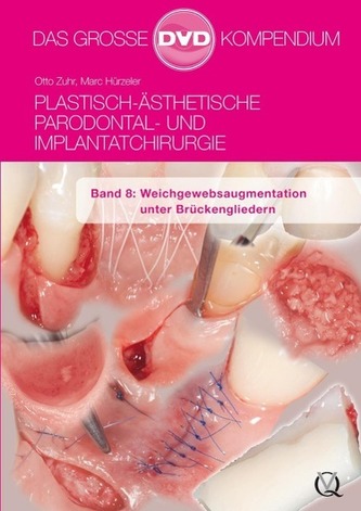 Plastisch-Ästhetische Parodontal- und Implantatchirurgie