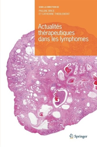 Actualités Thérapeutiques Dans Les Lymphomes