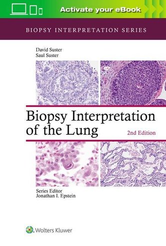 Biopsy Interpretation of the Lung (Biopsy Interpretation Series)