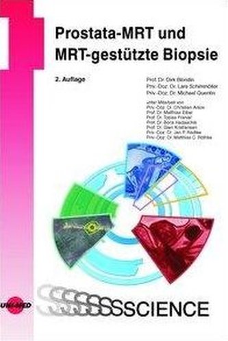 Prostata-MRT und MRT-gestützte Biopsie