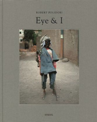 Eye and I