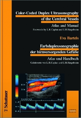 Farbduplexsonographie der hirnversorgenden Gefäße