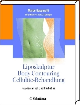 Liposkulptur - Body Contouring - Cellulite-Behandlung