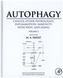 Autophagy: Cancer, Other Pathologies, Inflammation, Immunity, Infection, and Aging