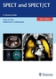 SPECT and SPECT/CT