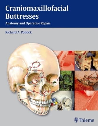 Craniomaxillofacial Buttresses Craniomaxillofacial Buttresses