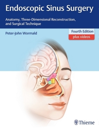 Endoscopic Sinus Surgery