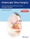 Endoscopic Sinus Surgery