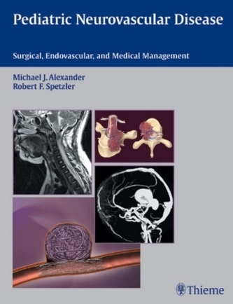 Pediatric Neurovascular Disease Pediatric Neurovascular Disease