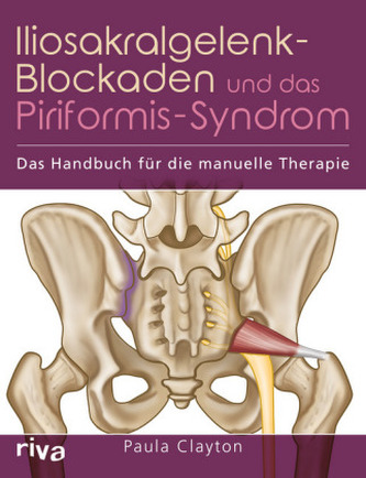 Iliosakralgelenk-Blockaden und das Piriformis-Syndrom Iliosakralgelenk-Blockaden und das Piriformis-Syndrom