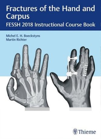 Fractures of the Hand and Carpus Fractures of the Hand and Carpus