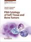 FNA Cytology of Soft Tissue and Bone Tumors