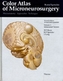 Intracranial Tumors