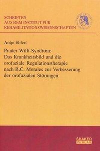 Prader-Willi-Syndrom: Das Krankheitsbild und die orofaziale Regulationstherapie nach R.C. Morales zur Verbesserung der orofazial
