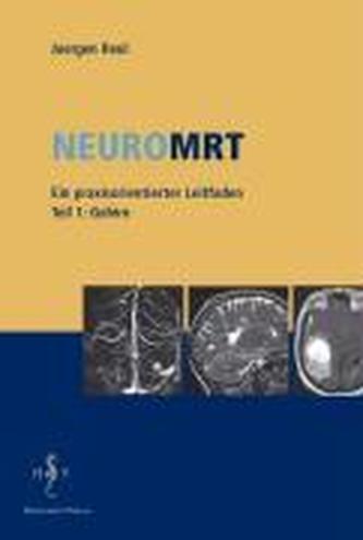 NeuroMRT 1