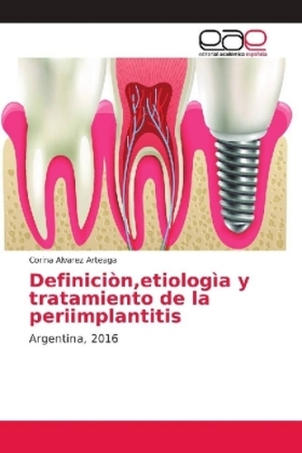Definiciòn,etiologìa y tratamiento de la periimplantitis