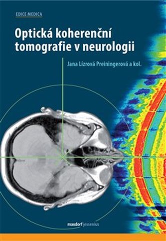 Optická koherenční tomografie v neurologii Optická koherenční tomografie v neurologii